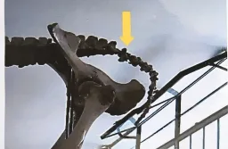 Espécimen de Agenesia De Vertebras Coccígeas
