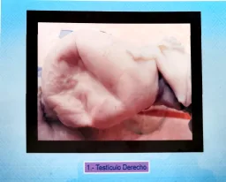 Espécimen de Hermafroditismo En Vacuno